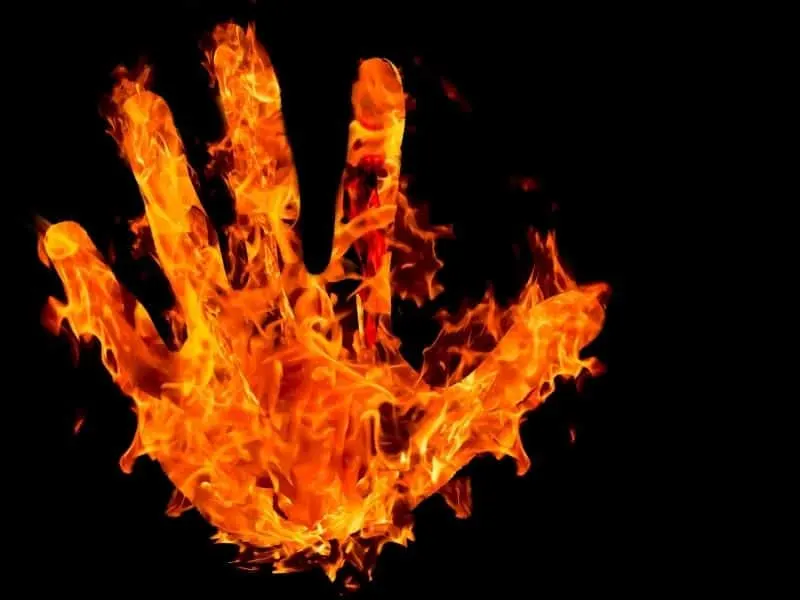 Burning hand