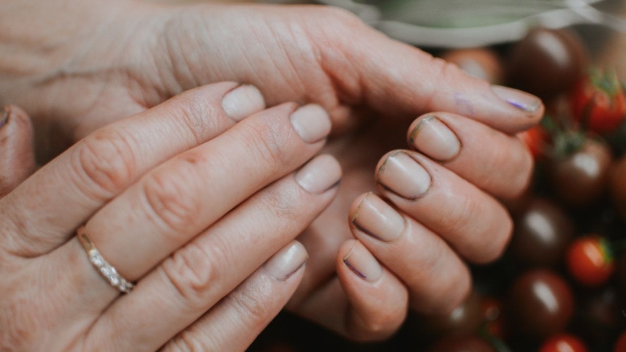 Woman's hands after gardening with dirt under her nails, this can lead to infection