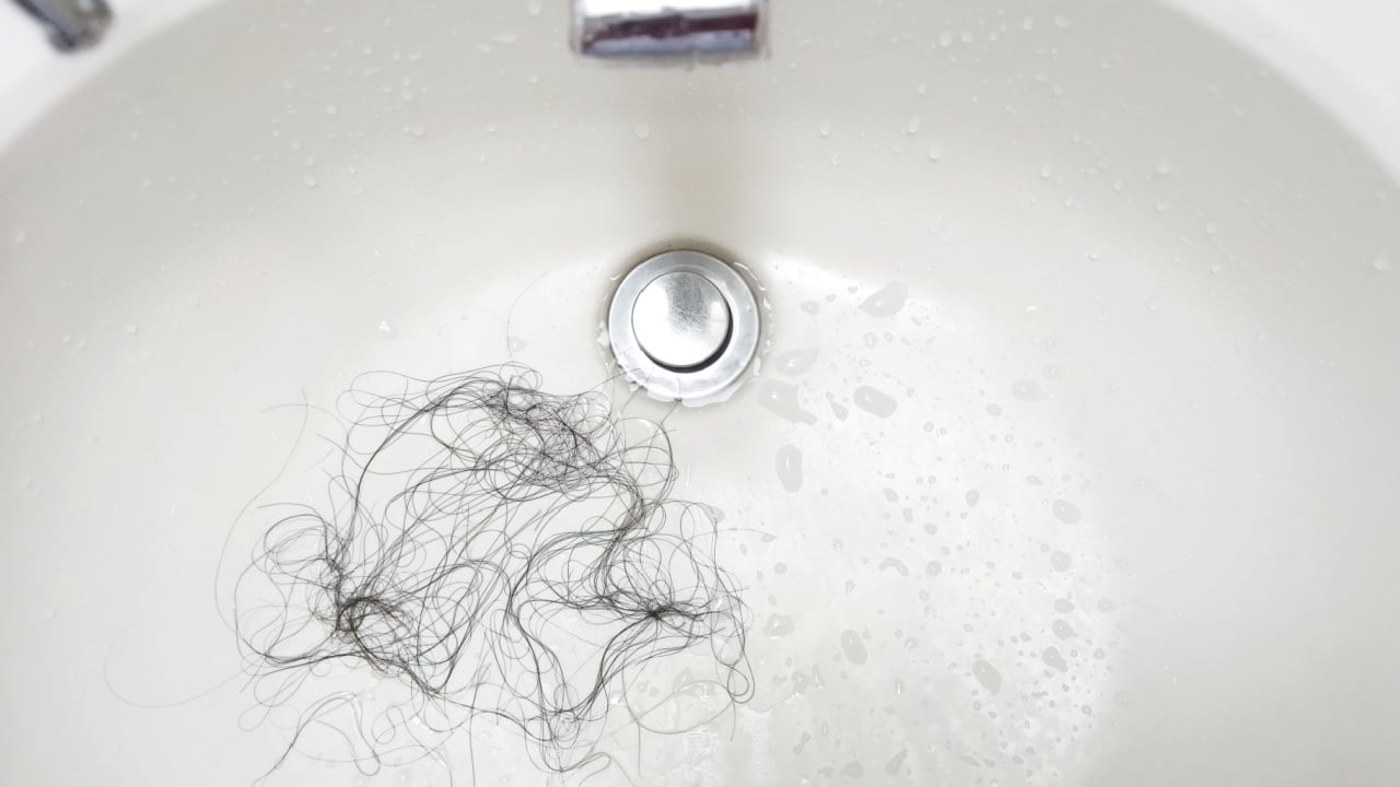 Young woman brushing her hair. Many hair loss on filter in washbasin in bathroom. Healthcare, medical concept. Copy space.