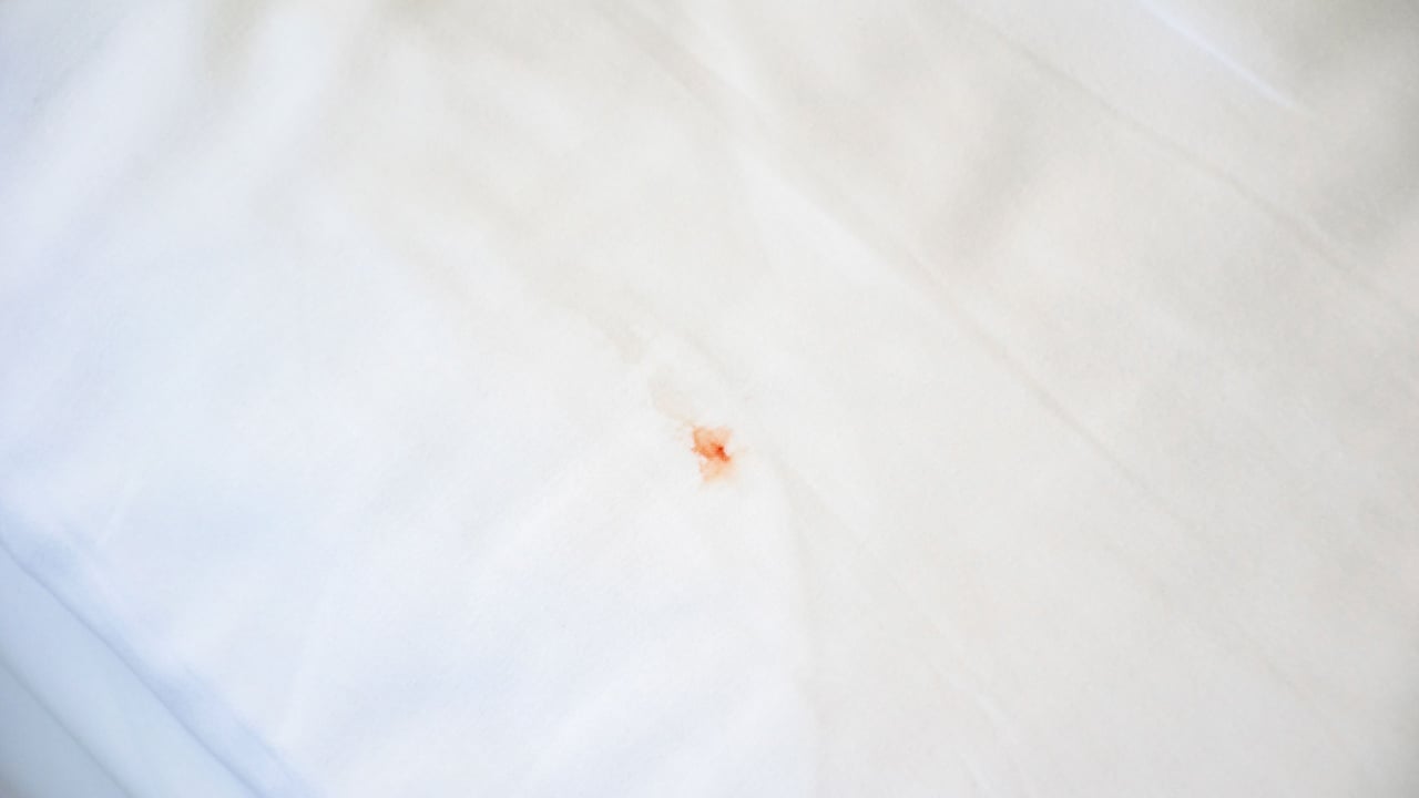 Bloodstained on a white bed sheet with copy space, cleaning concept.