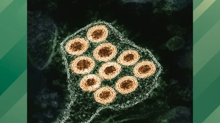 CDC makes announcement about rabies.