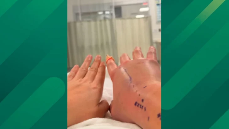 Woman Describes Copper Head Bite, Post Goes Viral