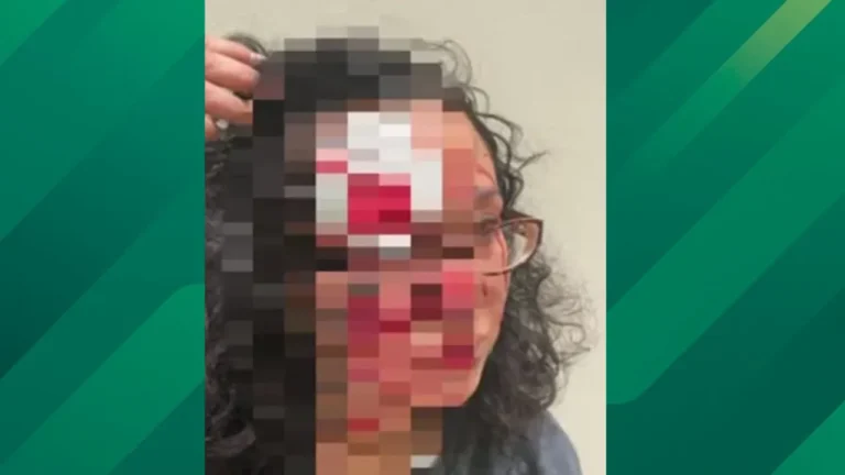 Injured woman.